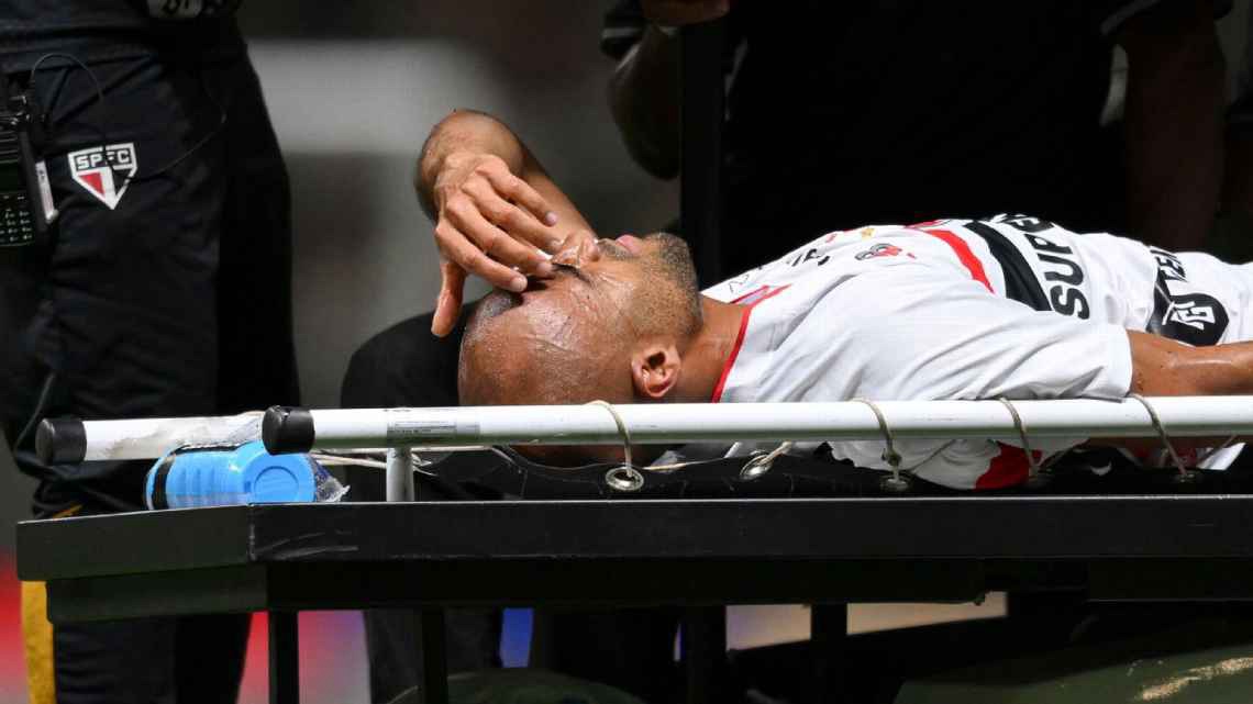 Leia mais sobre o artigo Lesões afastam trio do São Paulo Futebol Clube e preocupam comissão técnica